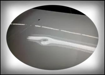 DentedHood-before-joe-the-bodyman Dent Removal Toronto - GTA | Mobile Dent Removal Gallery